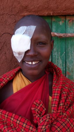 Melua after surgery