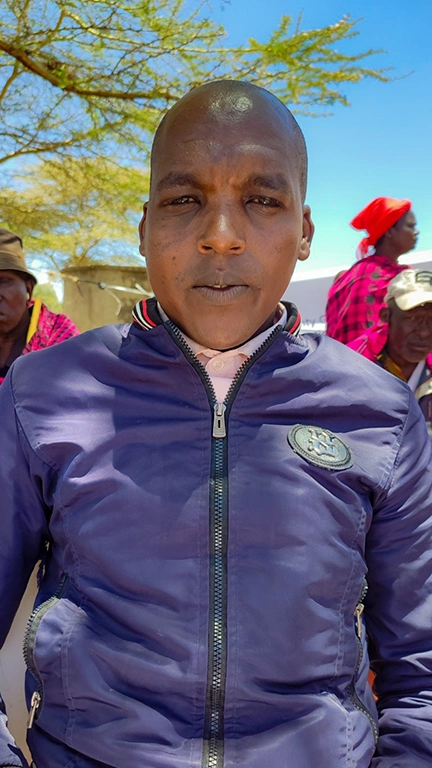 A young man wearing a bomber jacket looks at the camera. You can see other people and a tent in the background. His right eye looks slightly swollen.